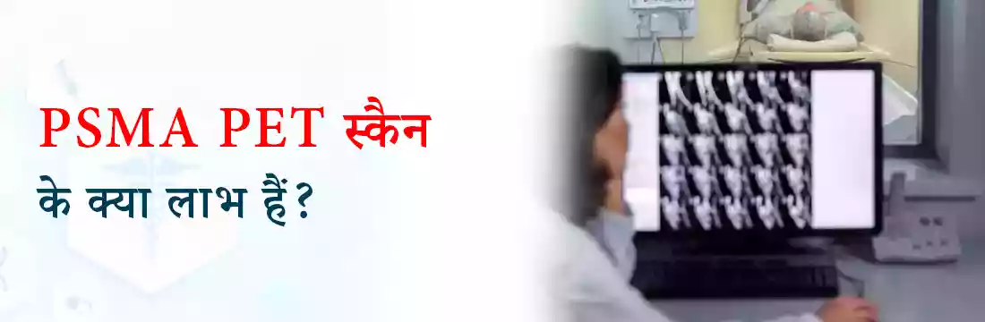 PSMA PET स्कैन के क्या लाभ हैं?